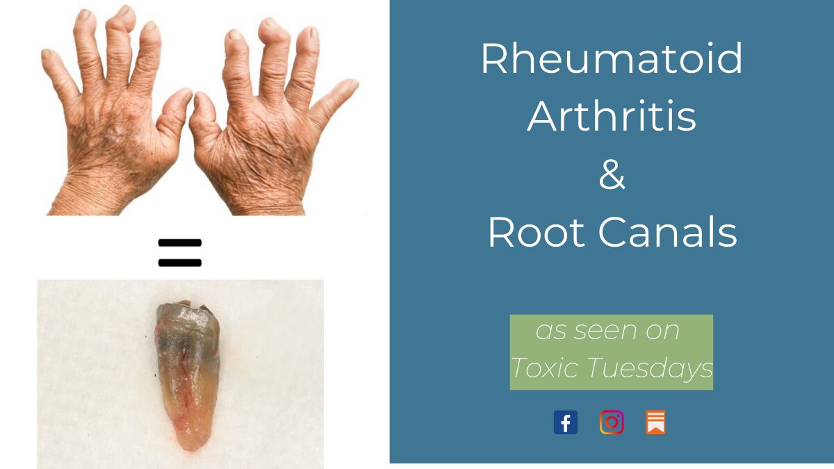 Rheumatoid Arthritis and Root Canals