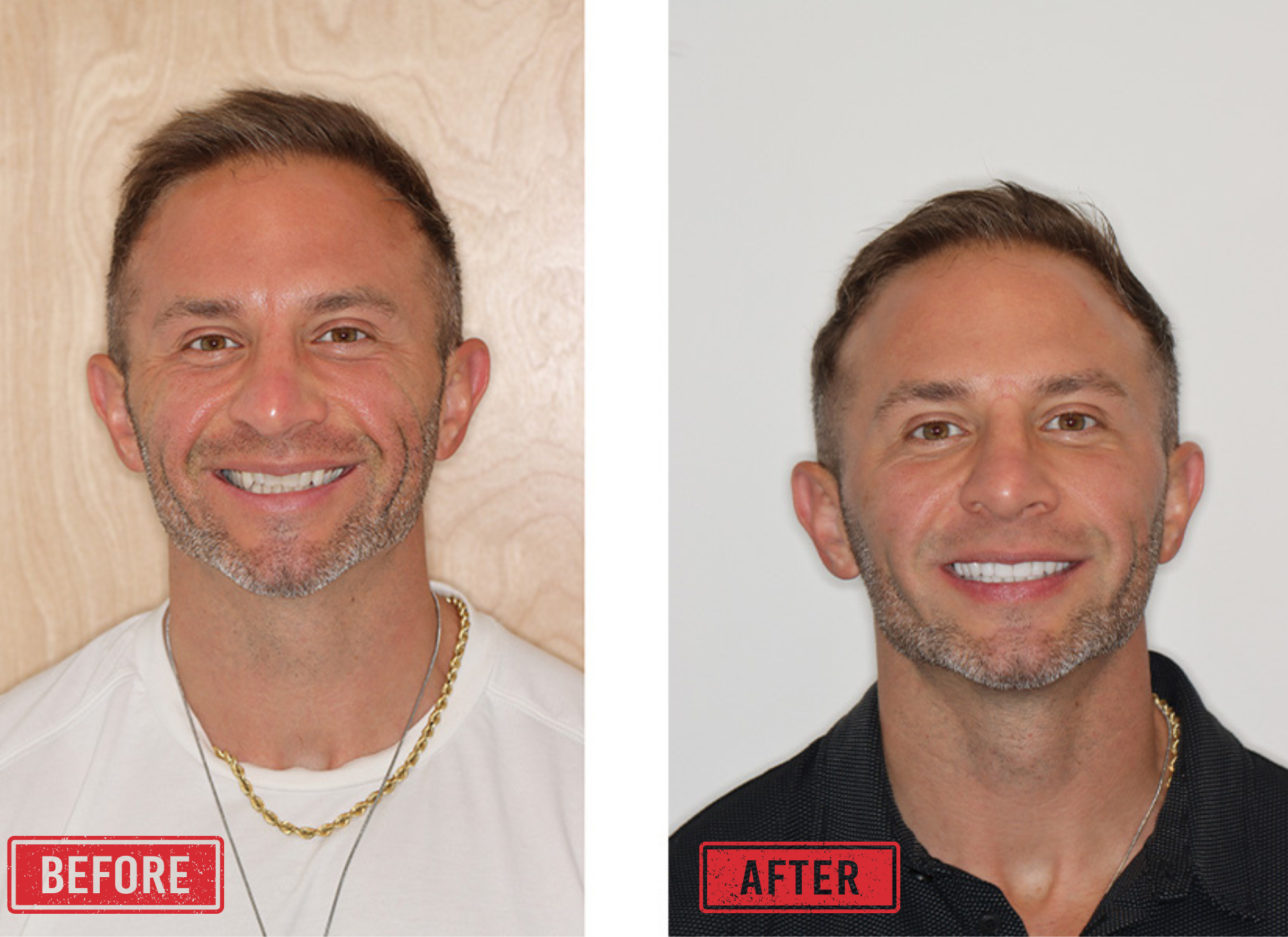 Before and after cosmetic dentistry Portland Oregon BDC