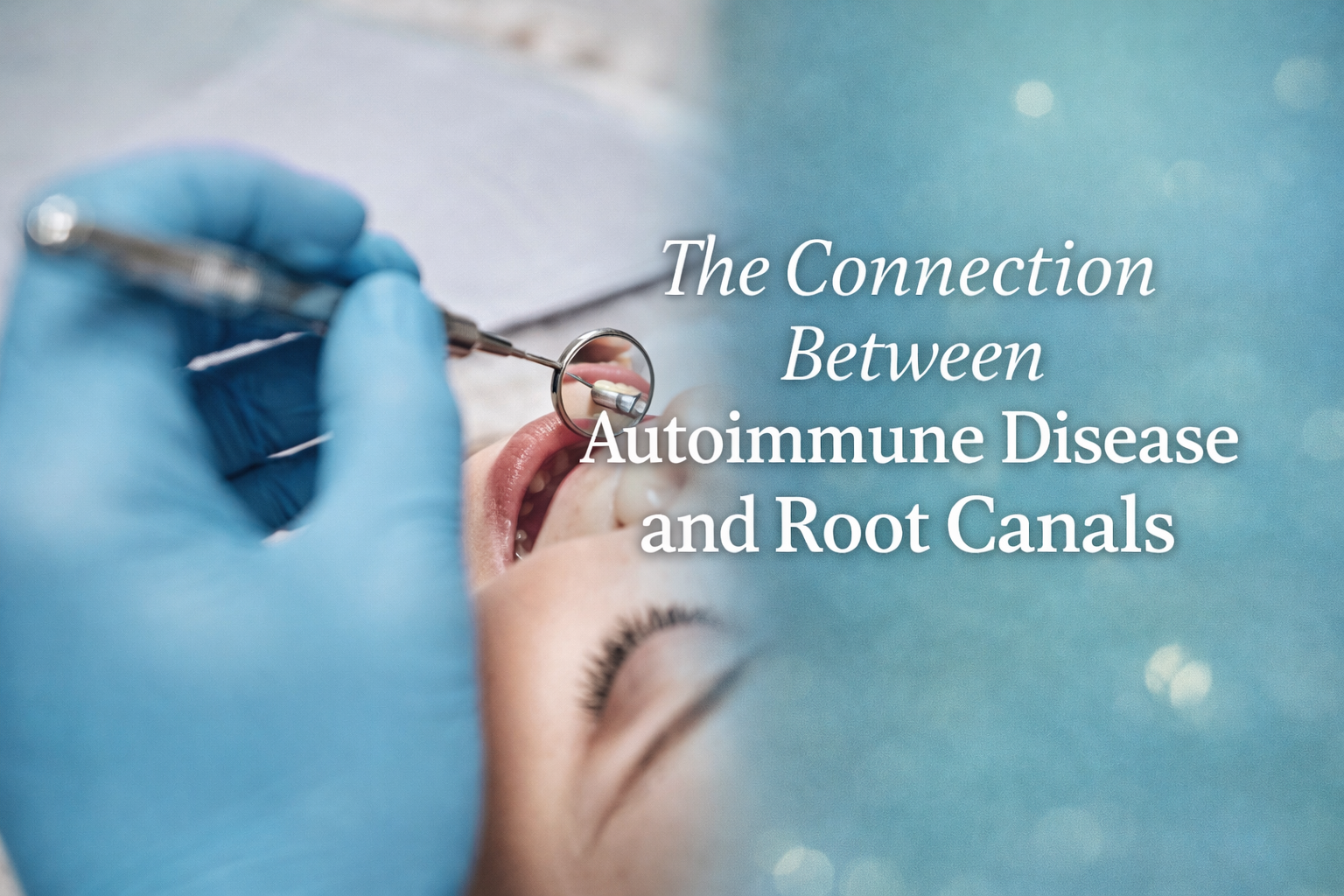Dental exam image showing a patient during an oral evaluation with dental mirror and explorer, representing the connection between autoimmune disease, chronic oral infection, and root canal concerns | Blodgett Dental Care